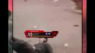 R99 ptsd [better with sound]