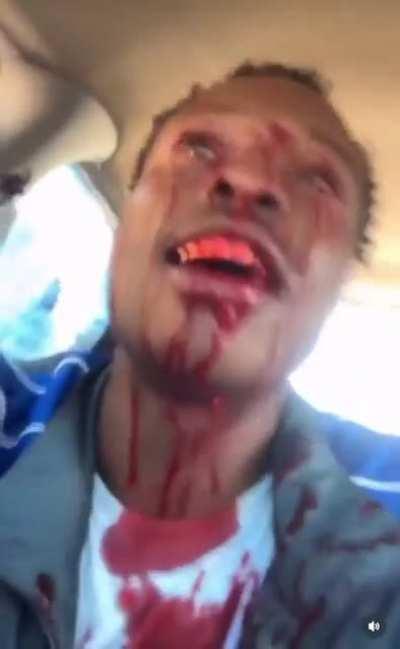 Nigga caught a face shot and went straight to social media.