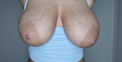 It is the appearance of milf boobs, which isn't ideal