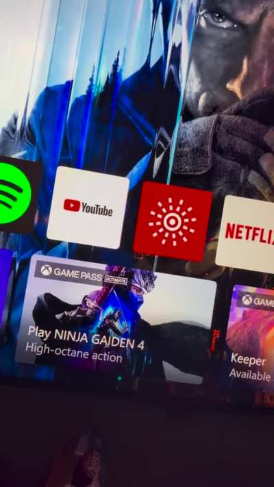 Anyone know what these weird lines are on my Xbox series X?