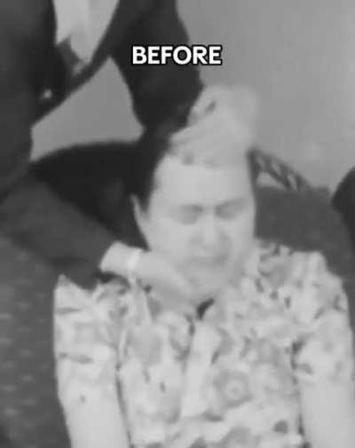 Lobotomy is good actually 🤓☝️