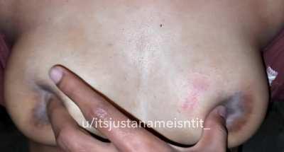 My favourite stress balls 🫠