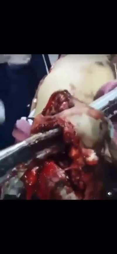 Man finds himself unlucky to survive 200mph crash