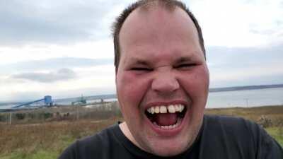 The Guy Laughing Really Hard in November 2020