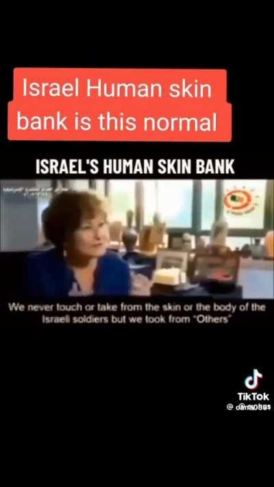 Where did that skin come from? 