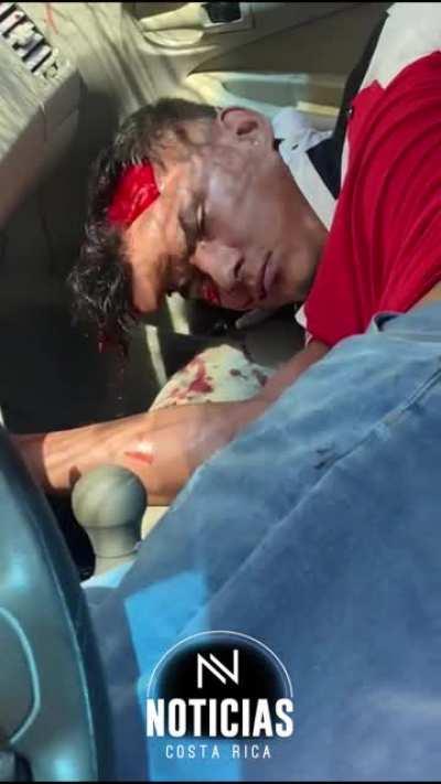 [NSFL] aftermath of violent crash