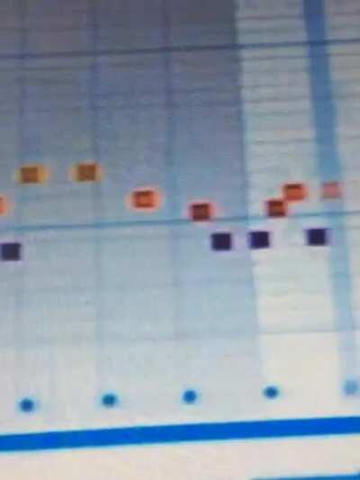 RickRolled by ten year old daughter. She had to create something for music class for school. Then sent it to me.