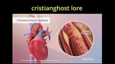 Es chistoso porque los watones se mueren