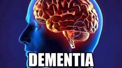 Epik rep betils of histori