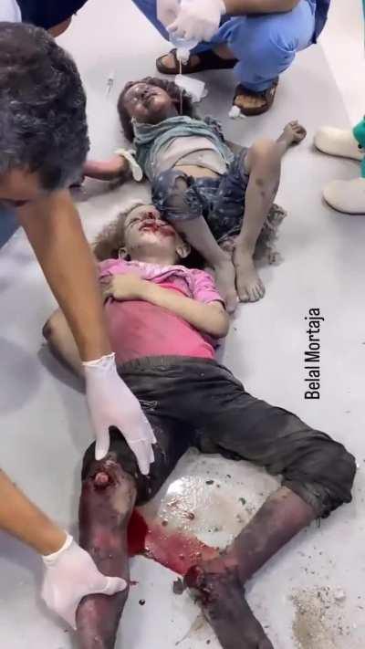 ⚠️Warning : Very graphic⚠️I can't imagine the pain she is going through. None of this should happen to the poor kids. Something should be done man this can't go on like this.