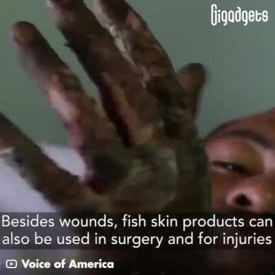 “This fish skin bandage brings new hope to the treatment of burn wounds. Researchers from all over the world have been developing and testing this treatment for years.”