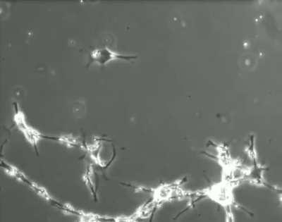 These are neurons trying to connect. Your memories, your dreams, everything you know about the universe is thanks to these little guys and how they interact