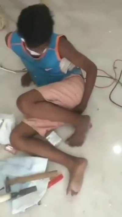 Drill up the butt win a trip to er