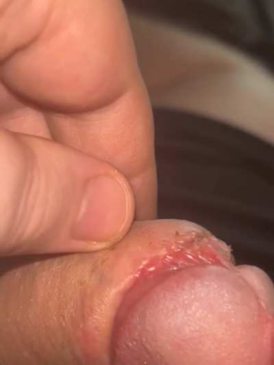 How’s it looking? Should I be worried about anything? (Day 44) 