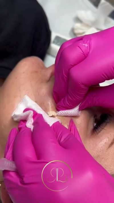 Right technique or not?