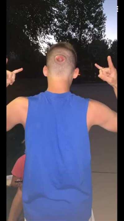 Skateboarding without a helmet