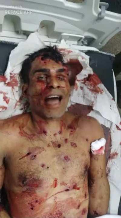 I want to break free