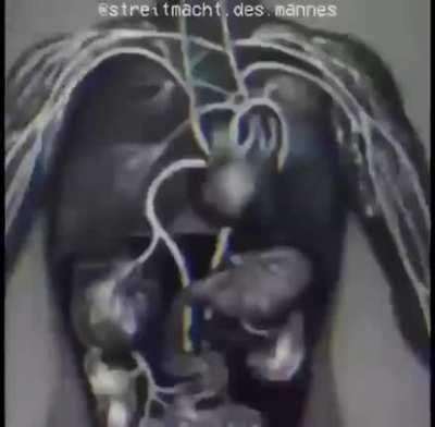 I will not take my normal pills