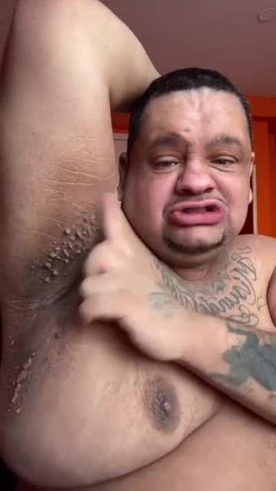 Barnacle Boy 🤮🤢