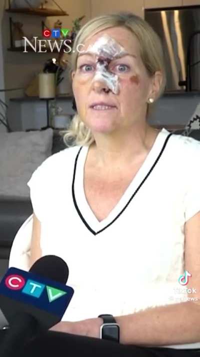 Woman fall in a giant pothole while cycling in Montreal