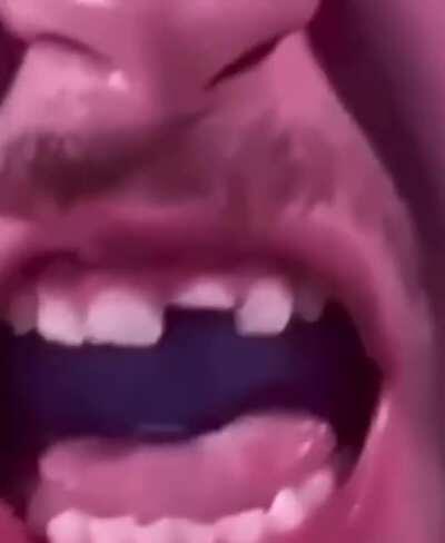 Rat trap vs tongue (turns out to be vs teeth) // (no blood)