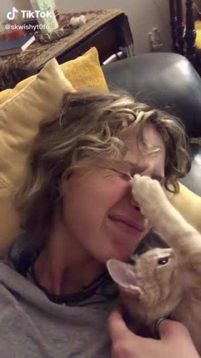 Cats dlaw get stuck on girls eyelid