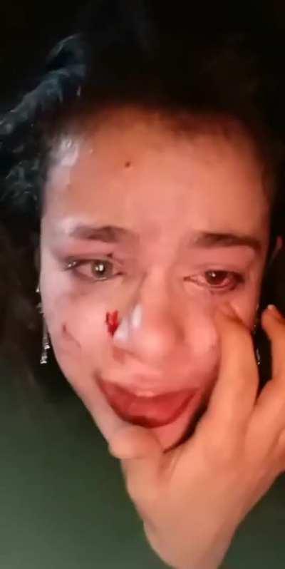 Cemre Demirel’in dövdüğü sevgilisi, geçen sene başka bir kızı darp edip bu hale getirmiş. bunlar nasıl bir psikopat lan SJDHFŞLSIJDHGLIDFJGDFGDFG