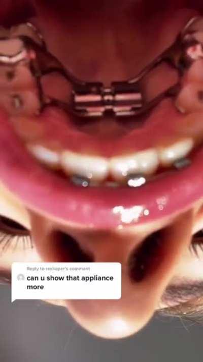 Thanks, I hate dentistry