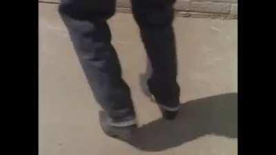 Hard to watch it (gross)