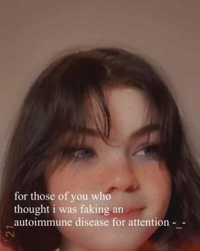 i almost died from anaphylactic shock yesterday lmao