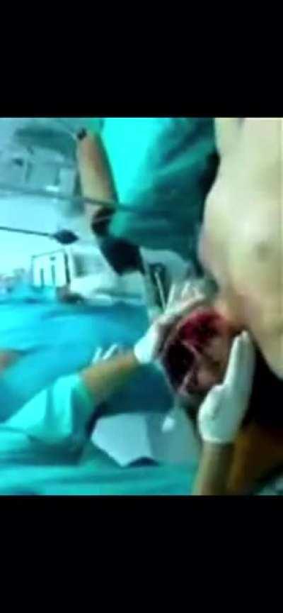 Yes Ik potato quality but it’s the only one I could find. be careful jumping into into shit this happens more then you think.