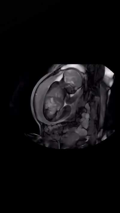 Reason why babies love gentle patting for sleep