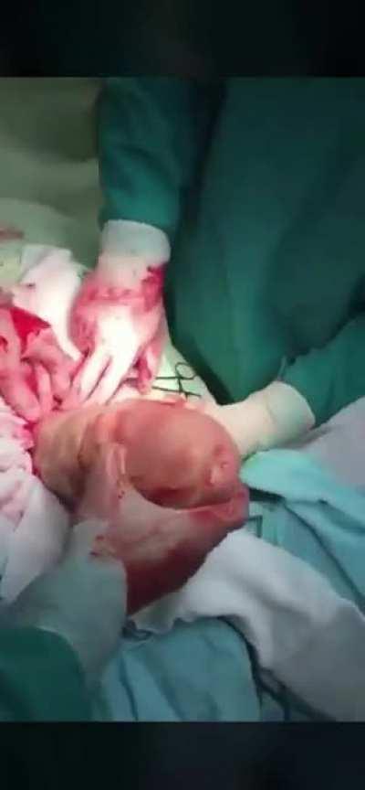 Kan vs. sevmiyorsanız izlememenizi tavsiye ederim