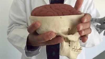 What happens to the brain when head trauma occurs.