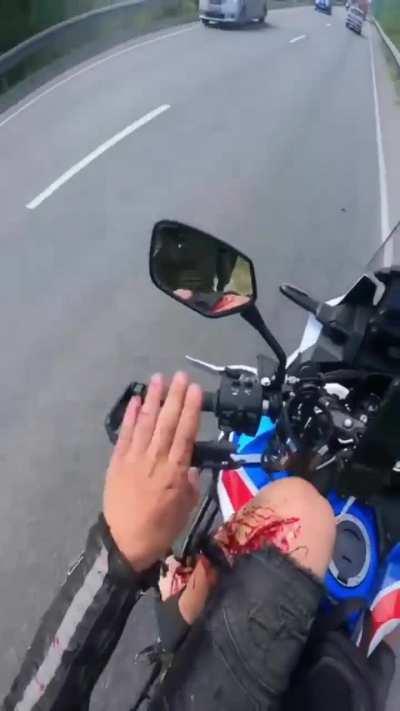 This is why wearing proper gear when riding a bike is essential