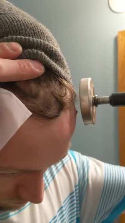 found out I had a hilti pin stuck in my head after almost 3 years