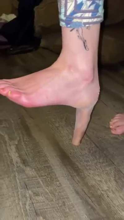 I mean… it definitely does look like a skin heel