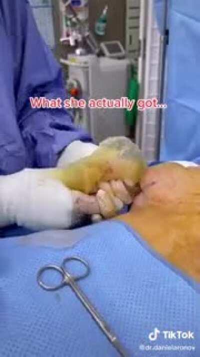 I’m so sorry about the music but his was just too gross not to share