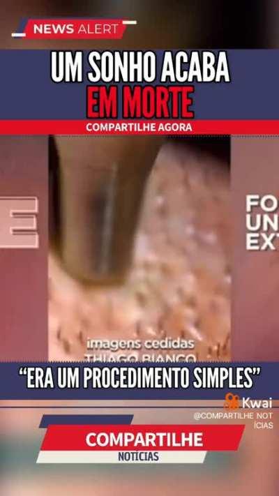 Como as pessoas brincam com cirurgia.