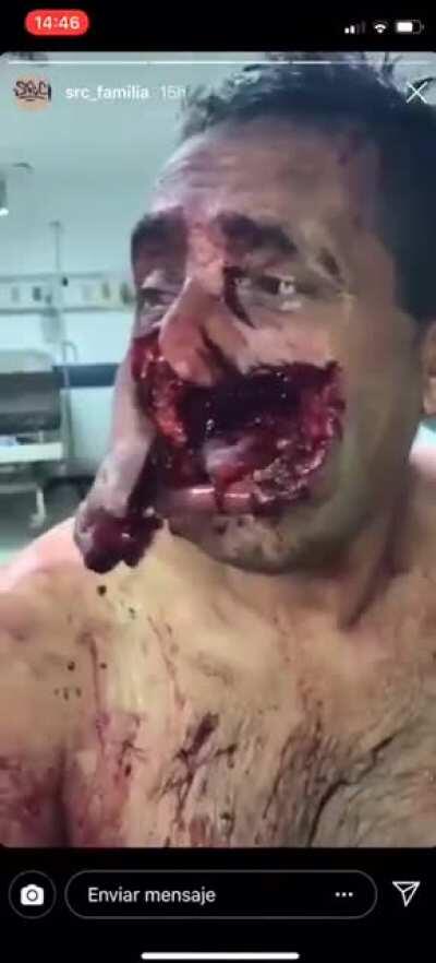 That sure hurt. Poor guy