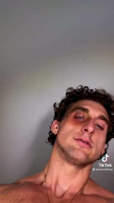 Simple exchange : Prank mother, get bruised eye.