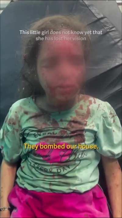 Little girl doesn't know yet she lost her vison