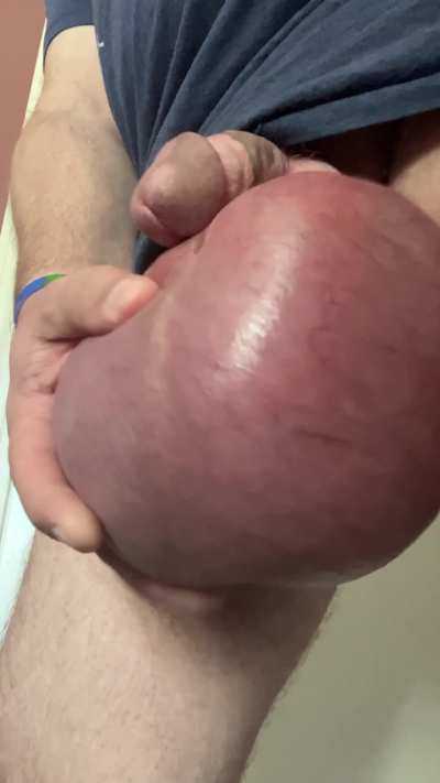 The Swinging saline sack