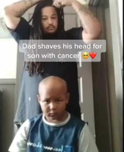 Dad shaves his head for his son
