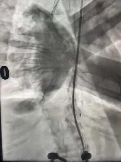 Take a guess at what's happening!