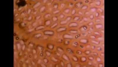 Azerbaijan and Armenia counting each other's casualties: