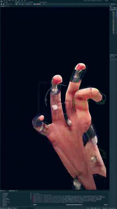 failed bone transplant wip