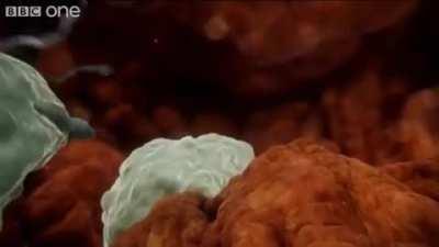 Sperm attacked by woman's immune system