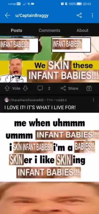 your captainbraggy is: skin infant babies