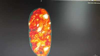 The baby inside of one of the eggs in Josefina